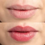 بالم لب ارگانیک سیرا بیز | محافظ و ترمیم کننده لب - Image 3